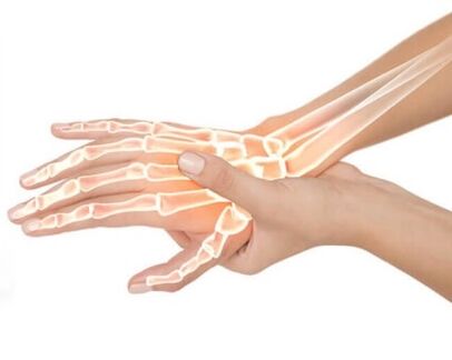 Hondrox wird auf den betroffenen Bereich aufgetragen