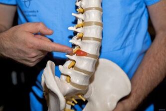 Warum tut der Rücken im unteren Rücken weh und was zu tun ist