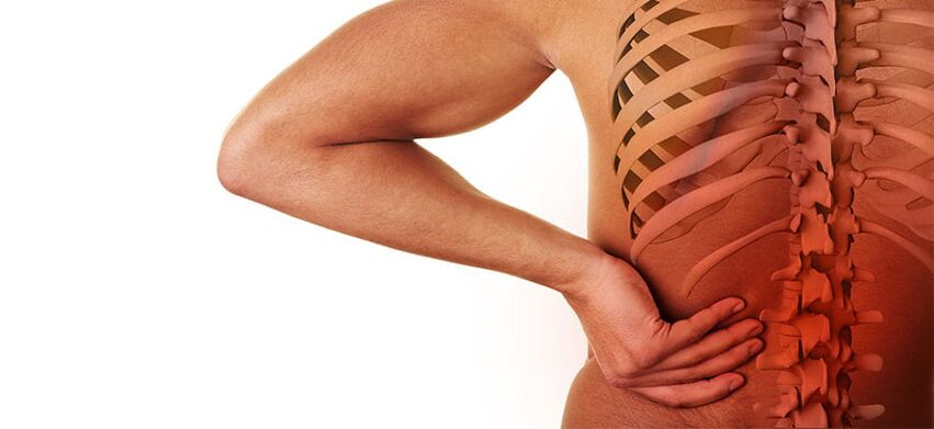 Symptome einer lumbalen Osteochondrose